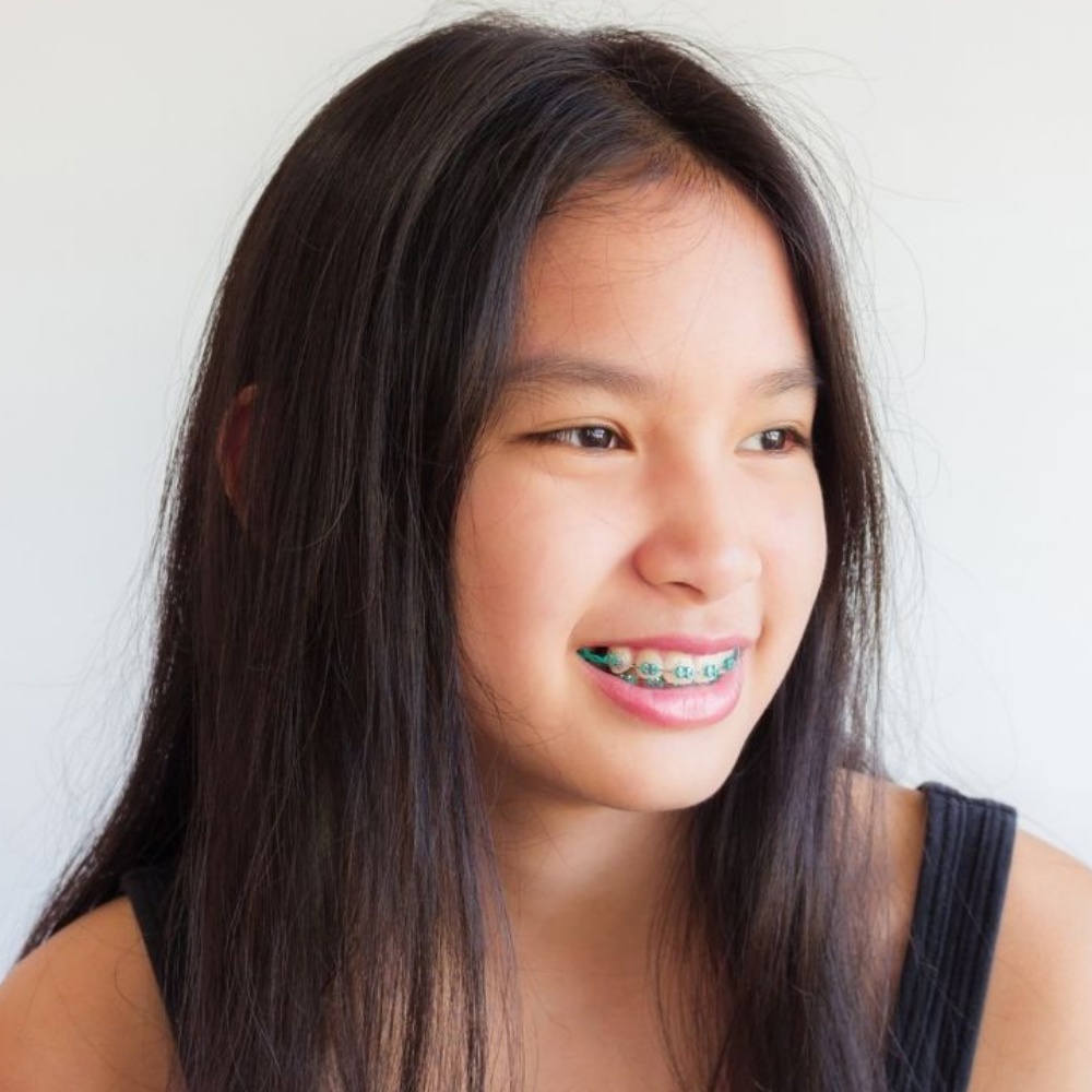 Children Dentistry Colorado Kids Pediatric Dentistry Highlands Ranch Castle Pines CO services braces and Orthodontics
